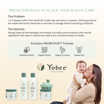 Eczema Scalp Support Babies